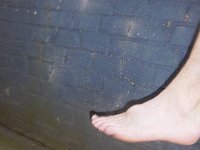 IMGP1333   Richard&#39;s swollen foot after a studding